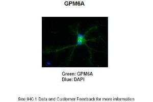 Primary Antibody Dilution: 1:250Secondary Antibody: Anti-rabbit-AlexaFluor 488 Secondary Antibody Dilution: 1:5000Color/Signal Descriptions: GPM6A: Green DAPI: Blue  Gene Name: GPM6A Submitted by: Anonymous (GPM6A anticorps  (C-Term))