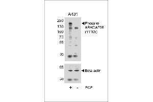 Western blot analysis of lysates from A431 cell line, untreated or treated with EGF, 100 ng/mL, using Phospho-HUN-ARHG (ABIN6241039 and ABIN6578944) (upper) or Beta-actin (lower).
