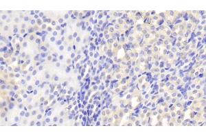 Detection of CLTA in Mouse Kidney Tissue using Polyclonal Antibody to Clathrin, Light Polypeptide A (CLTA) (CLTA anticorps  (AA 5-234))