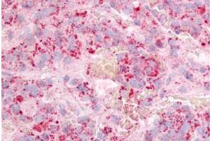 anti-G Protein-Coupled Receptor 12 (GPR12) (Extracellular Domain) antibody