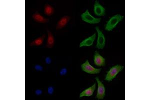 ABIN7093314 and ABIN7097333 staining Hela cells by IF/ICC.