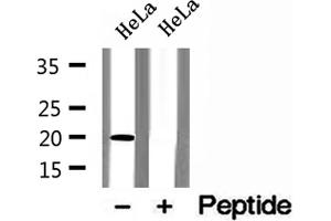 Western blot analysis of extracts of HeLa cells, using ARL3 antibody.