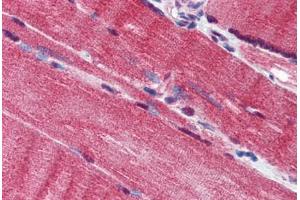 Human Skeletal Muscle (formalin-fixed, paraffin-embedded) stained with IQWD1 antibody ABIN293866 at 10 ug/ml followed by biotinylated goat anti-rabbit IgG secondary antibody ABIN481713, alkaline phosphatase-streptavidin and chromogen. (DCAF6 anticorps  (AA 800-850))