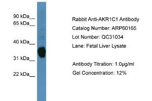 WB Suggested Anti-AKR1C1  Antibody Titration: 0. (AKR1C1 anticorps  (N-Term))