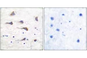 Immunohistochemistry analysis of paraffin-embedded human brain tissue, using mGluR6 Antibody.