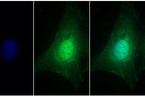 Detection of HSPG2 in Human U2OS cell using Polyclonal Antibody to Heparan Sulfate Proteoglycan 2 (HSPG2)