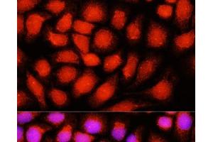 Immunofluorescence analysis of Hela cells using DNAJB14 Polyclonal Antibody at dilution of 1:100 (40x lens). (DNAJB14 anticorps)