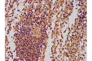 IHC image of ABIN7162698 diluted at 1:500 and staining in paraffin-embedded human spleen tissue performed on a Leica BondTM system. (PNPLA5 anticorps  (AA 90-205))