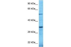 Host:  Rabbit  Target Name:  TULP2  Sample Type:  OVCAR-3 Whole Cell lysates  Antibody Dilution:  1. (TULP2 anticorps  (C-Term))