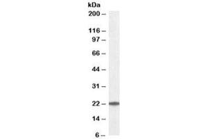 Western blot testing of K562 lysate with UBE2T antibody at 0.