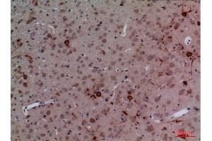 Immunohistochemistry (IHC) analysis of paraffin-embedded Rat Brain, antibody was diluted at 1:100.