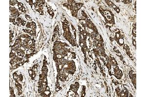 IHC analysis of NSF using anti-NSF antibody (ABIN7601630).