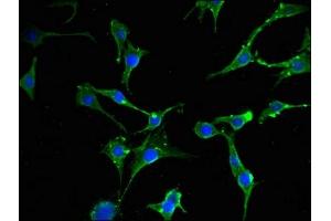Immunofluorescent analysis of MCF-7 cells using ABIN7152131 at dilution of 1:100 and Alexa Fluor 488-congugated AffiniPure Goat Anti-Rabbit IgG(H+L)