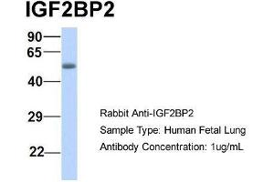 Host:  Rabbit  Target Name:  IGF2BP2  Sample Type:  Human Fetal Lung  Antibody Dilution:  1. (IGF2BP2 anticorps  (Middle Region))