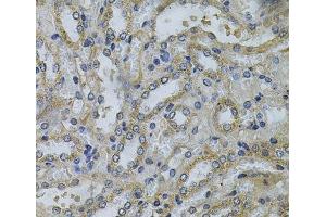 Immunohistochemistry of paraffin-embedded Mouse kidney using SERPINE2 Polyclonal Antibody at dilution of 1:100 (40x lens). (SERPINE2 anticorps)