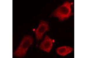 ABIN6268919 staining HuvEc cells by IF/ICC. (Caveolin-1 anticorps  (C-Term))