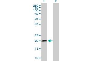Western Blot analysis of SCAND2 expression in transfected 293T cell line by SCAND2 MaxPab polyclonal antibody. (SCAND2 anticorps  (AA 1-152))