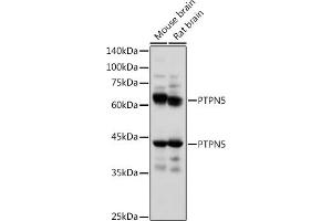 Western blot analysis of extracts of various cell lines, using PTPN5 antibody (ABIN7269705) at 1:1000 dilution.
