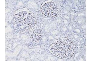 Immunohistochemical staining (Formalin-fixed paraffin-embedded sections) of human fetal kidney with WT1 monoclonal antibody, clone WT1/857 .