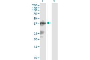 Western Blot analysis of C13orf31 expression in transfected 293T cell line by C13orf31 monoclonal antibody (M04), clone 2A1. (LACC1 anticorps  (AA 1-430))