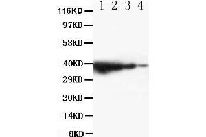 Western Blotting (WB) image for anti-Toll-Like Receptor Adaptor Molecule 1 (TICAM1) (AA 693-708), (C-Term) antibody (ABIN3042956)