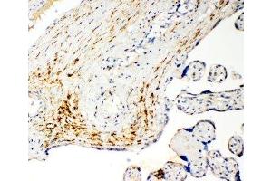 IHC-P: MCT5 antibody testing of human placenta cancer tissue