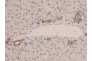 Detection of LDHB in Rat Liver Tissue using Polyclonal Antibody to Lactate Dehydrogenase B (LDHB)