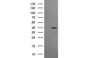 Image no. 1 for anti-Musashi Homolog 1 (Drosophila) (MSI1) antibody (ABIN1499574)