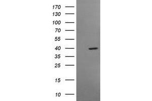 Image no. 1 for anti-Musashi Homolog 1 (Drosophila) (MSI1) antibody (ABIN1499574) (MSI1 anticorps)