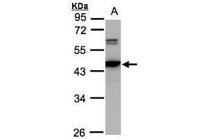 WB Image Sample(30 ug whole cell lysate) A:293T 10% SDS PAGE antibody diluted at 1:2000 (CAMK4 anticorps)