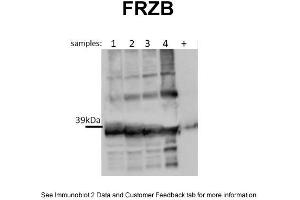 WB Suggested Anti-FRZB Antibody Titration: 0. (FRZB anticorps  (N-Term))