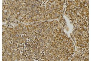 ABIN6279828 at 1/100 staining Human pancreas tissue by IHC-P.