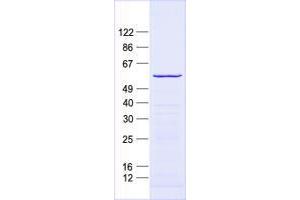 Validation with Western Blot