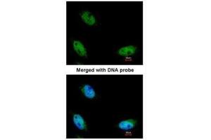 ICC/IF Image Immunofluorescence analysis of paraformaldehyde-fixed HeLa, using NSUN6, antibody at 1:200 dilution.