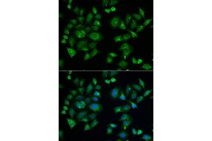 Immunofluorescence analysis of A549 cell using EPM2A antibody.