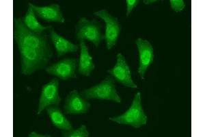 Immunofluorescence analysis of A549 cells using CDC5L Polyclonal Antibody (CDC5L anticorps)
