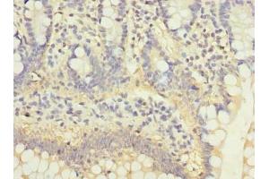 Immunohistochemistry of paraffin-embedded human small intestine tissue using ABIN7175029 at dilution of 1:100 (C5ORF22 anticorps  (AA 101-420))