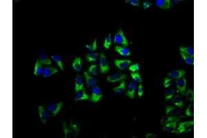 Immunofluorescence staining of Hela cells with ABIN7145792 at 1:66, counter-stained with DAPI. (BROX anticorps  (AA 288-409))