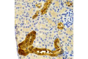 Immunohistochemistry of paraffin-embedded mouse kidney using PVALB antibody at dilution of 1:200 (400x lens). (PVALB anticorps)