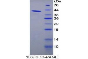 SDS-PAGE (SDS) image for Kininogen 1 (KNG1) (AA 22-379) protein (His tag) (ABIN1980912)