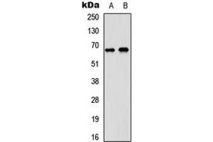 Western blot analysis of DDX5 expression in A431 (A), SHSY5Y (B) whole cell lysates. (DDX5 anticorps  (C-Term))