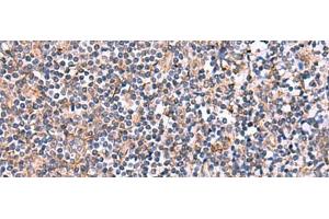 Immunohistochemistry of paraffin-embedded Human tonsil tissue using INPP5B Polyclonal Antibody at dilution of 1:40(x200) (INPP5B anticorps)