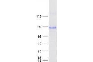 Validation with Western Blot