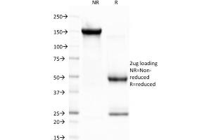 SDS-PAGE Analysis Purified CELA3B Monoclonal Antibody (CELA3B/1757). (Elastase 3B anticorps  (AA 82-238))