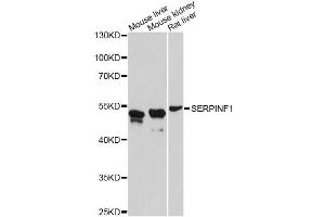 Western blot analysis of extracts of various cell lines, using SERPINF1 antibody (ABIN4905126) at 1:3000 dilution. (PEDF anticorps)