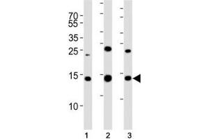 Western blot analysis of lysate from (1) 293T, (2) HL-60, (3) Jurkat cell line using SUMO2 antibody. (SUMO2 anticorps  (AA 63-93))