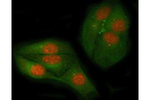 IF analysis of c-Myc using anti-c-Myc antibody (ABIN3043598) and anti-Beta Tubulin antibody (ABIN7602743). (c-MYC anticorps  (AA 257-439))
