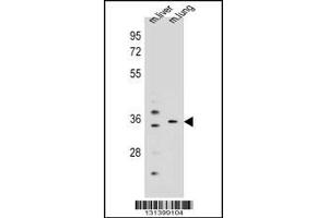 Western blot analysis in mouse liver,lung tissue lysates (35ug/lane). (KCNRG anticorps  (C-Term))