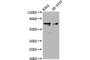 Western Blot Positive WB detected in: K562 whole cell lysate, SH-SY5Y whole cell lysate All lanes: ALOX12 antibody at 3. (ALOX12 anticorps  (AA 508-658))