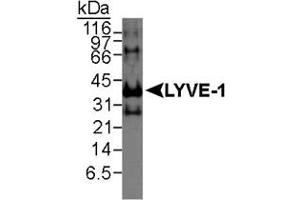 Western blot analysis of LYVE1 in recombinant human protein using LYVE1 polyclonal antibody . (LYVE1 anticorps  (AA 250-322))